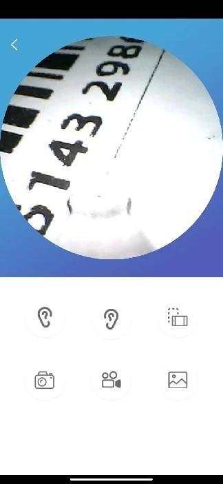 爱看智能app(visual earpick)下载,爱看智能,采耳app,可视挖耳app